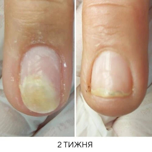 NAILSOFTHEDAY Onistop 8ml